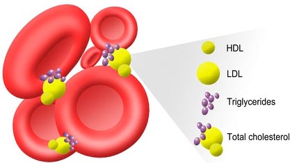 diagram of HDL, LDL, and triglycerides