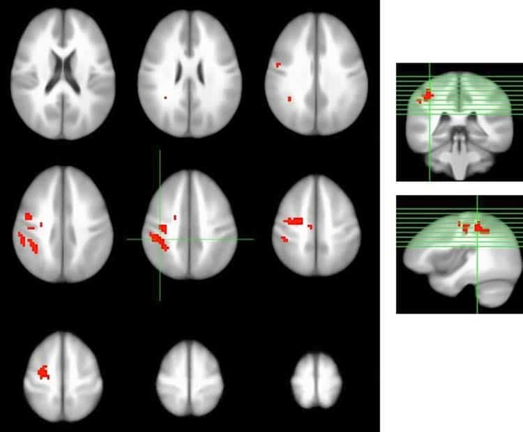 brain scans after berry consumption