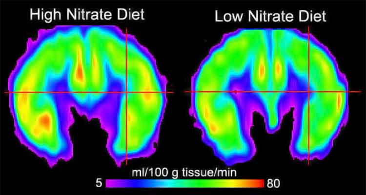 brain scans showing nitric oxide levels