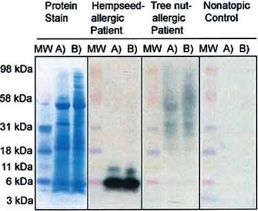 hempseed allergy test results