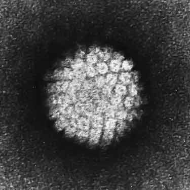 Papilloma Virus (HPV) as seen using an electron micrograph