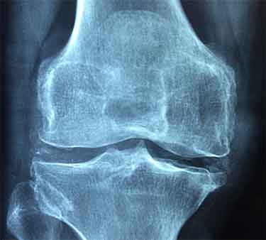 knee x-ray