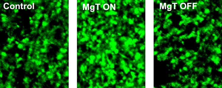 synaptic density with and without magnesium in brain