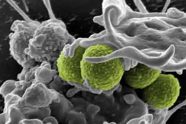 Methicillin-resistant Staphylococcus aureus (MRSA) bacteria