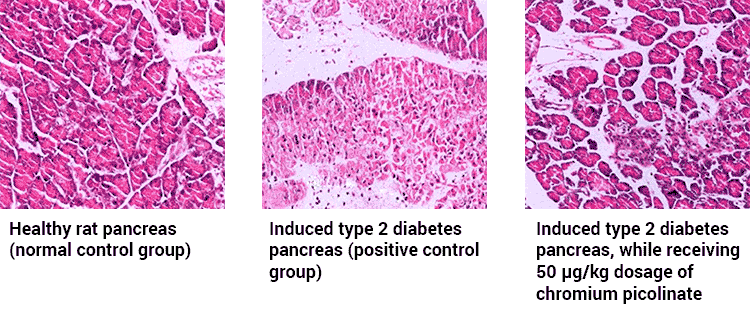 microscopic views of pancreas cells with and without chromium picolinate supplementation