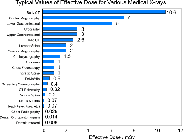 graph of radiation levels from x-rays and CT scans